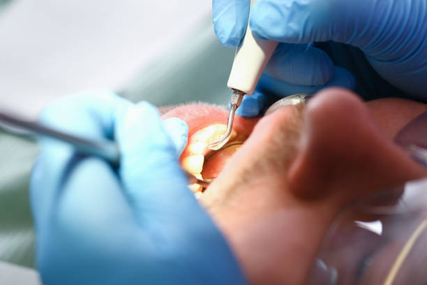 Best Emergency Treatment for Toothache in Saline, MI