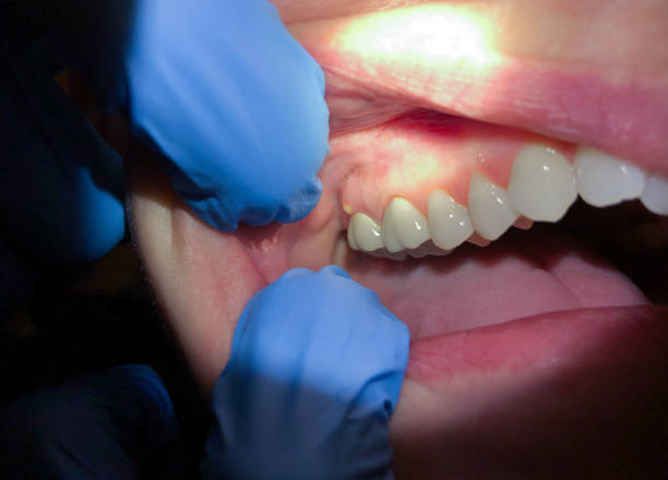 Best Same-Day Emergency Dentist in Saline, MI