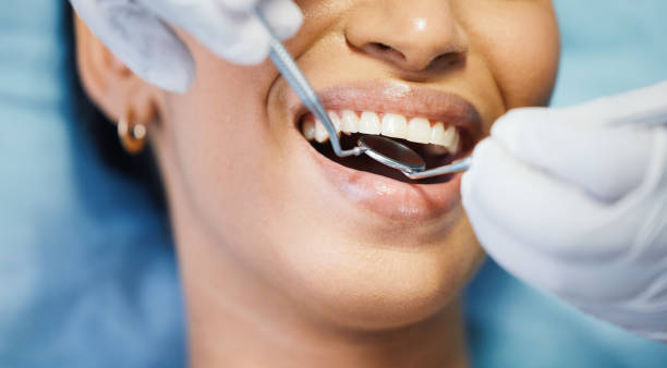 Best Emergency Wisdom Teeth Removal in Saline, MI